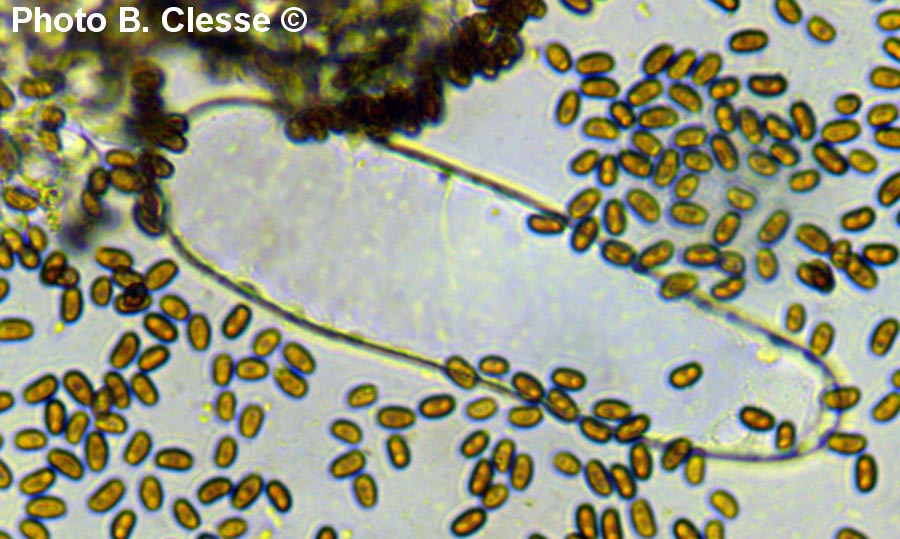 Cystide trabéculaire