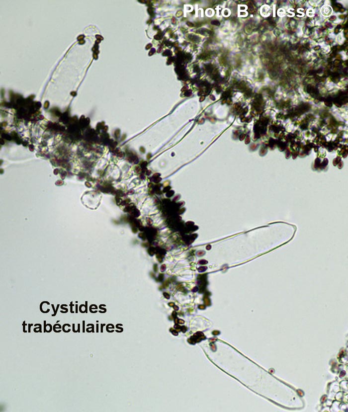 Cystide trabéculaire