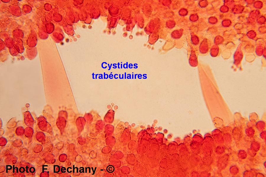 Cystide trabéculaire