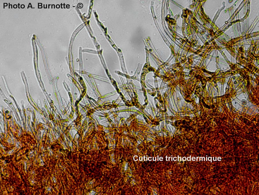 Cuticule trichodermique