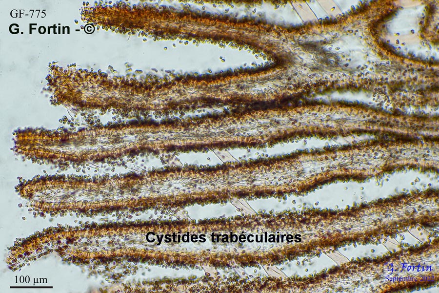 Cystide trabéculaire