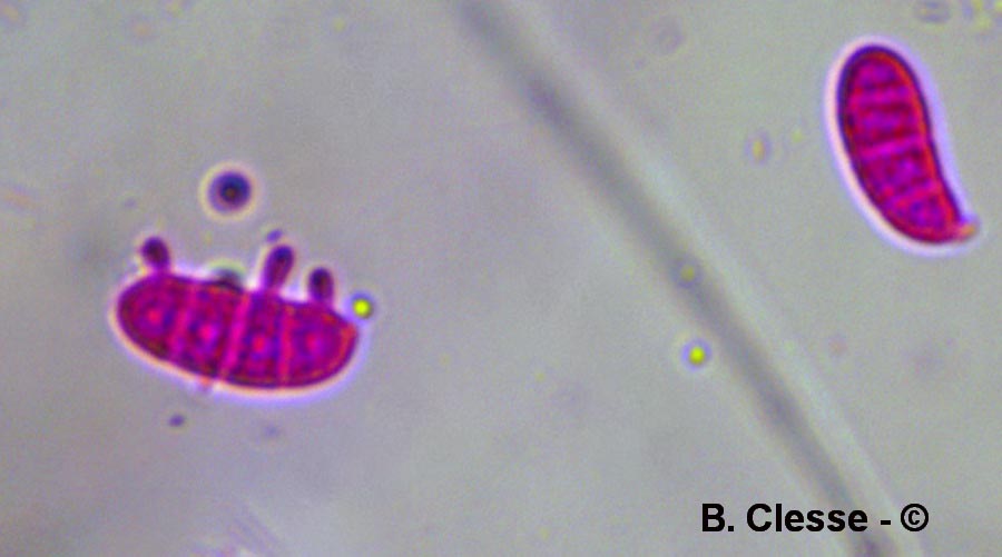 Hétérobasidiomycètes