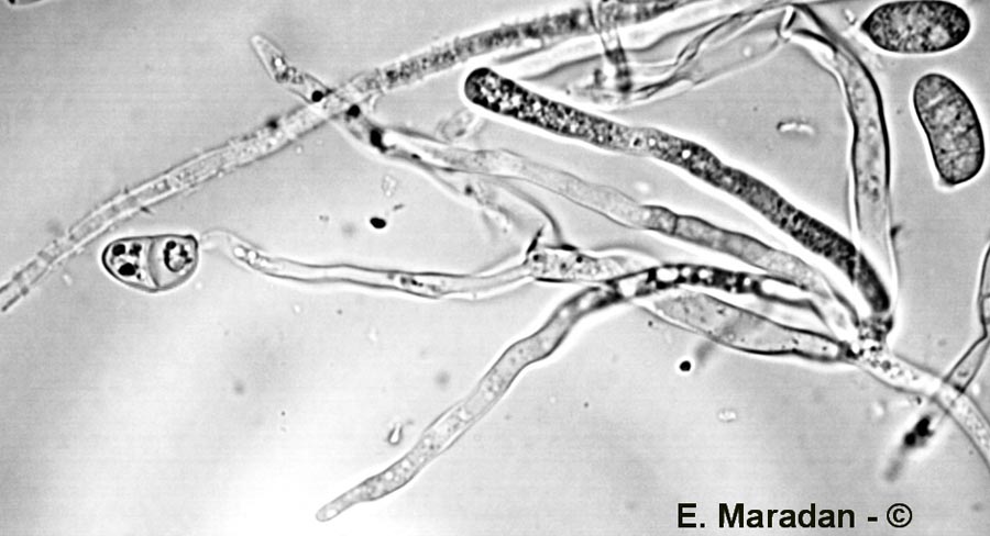 Hétérobasidiomycètes