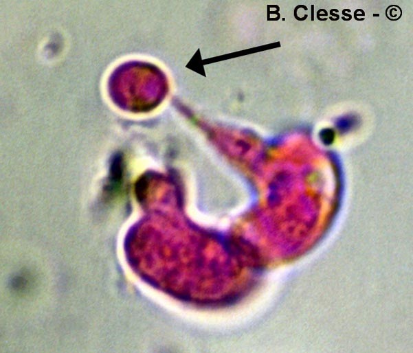 Hétérobasidiomycètes