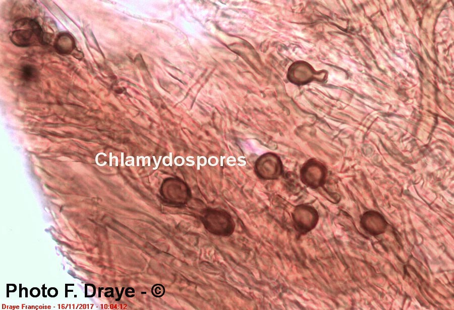 Chlamydospore