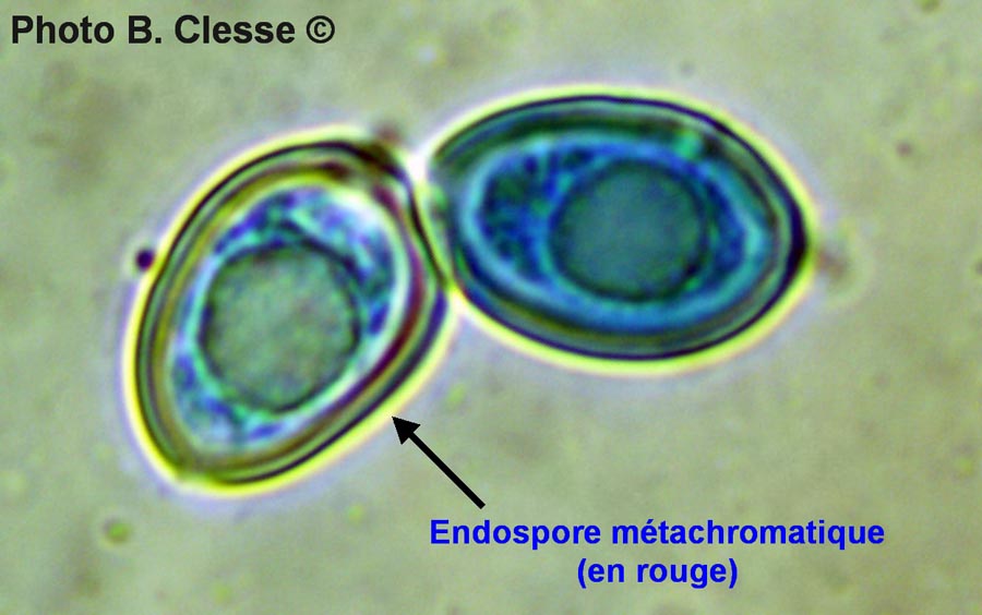 Endospore métachromatique