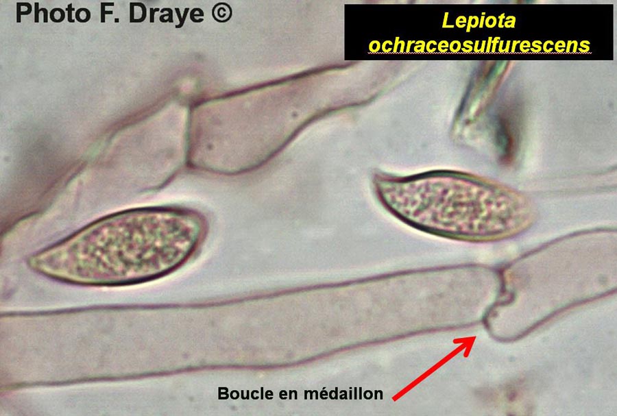 Boucle en médaillon