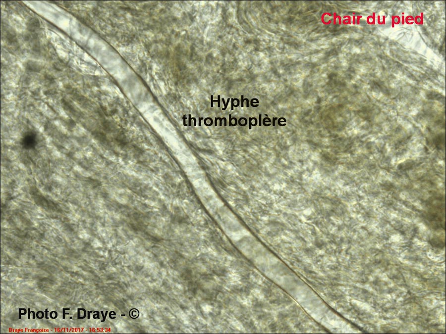 Hyphe thromboplère