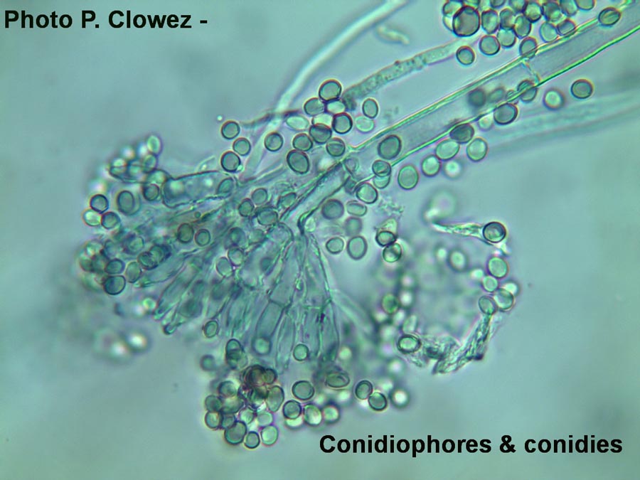 Conidiophore