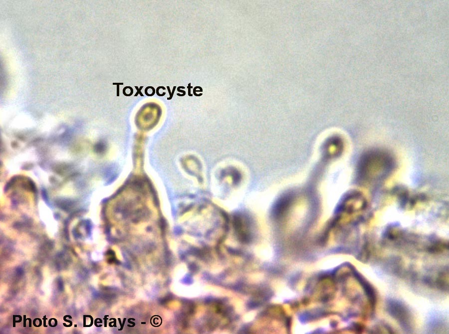 Toxocyste