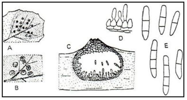 Pycnide