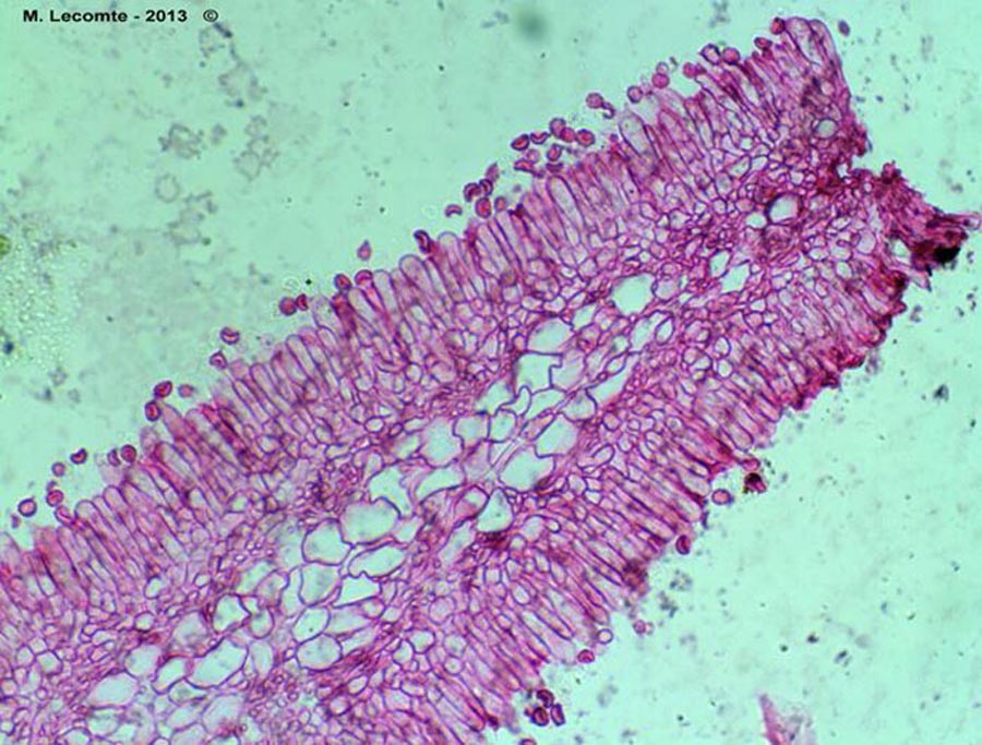 Structure à sphérocytes