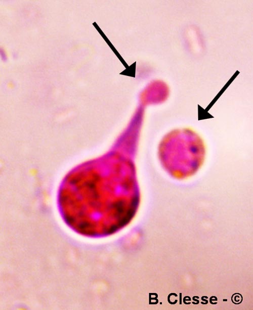 Hétérobasidiomycètes