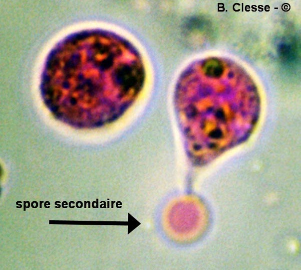 Spores secondaires