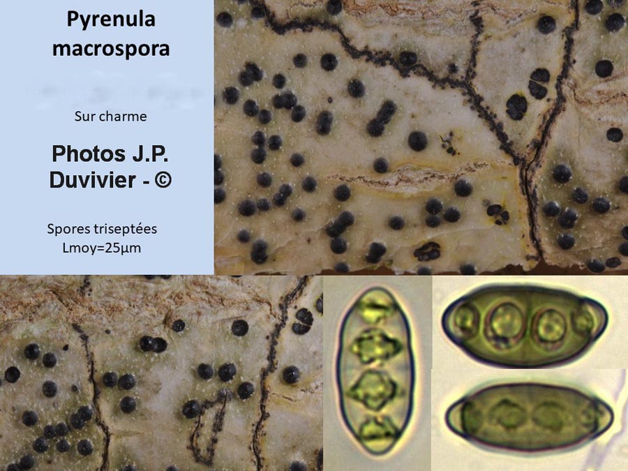 Pyrenula macrospora