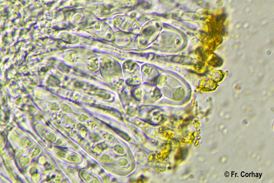 Teloschistes chrysophtalmus