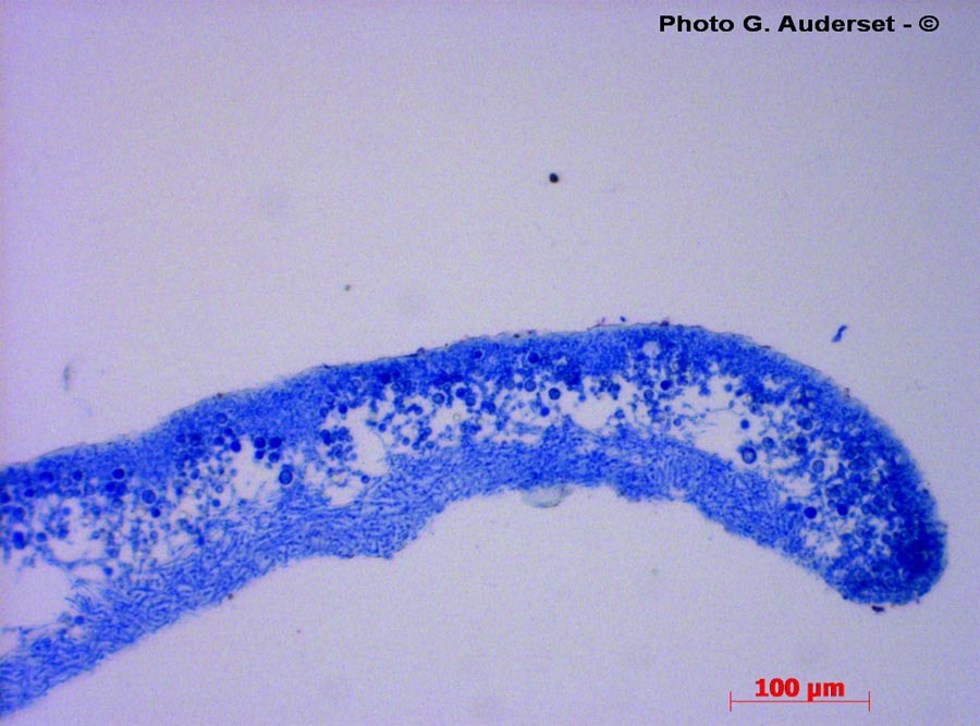 Xanthoria sp.