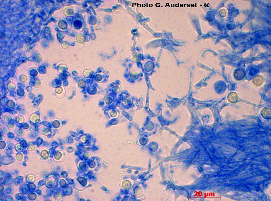 Xanthoria sp.