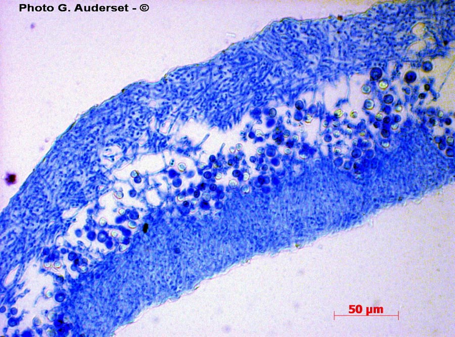 Xanthoria sp.