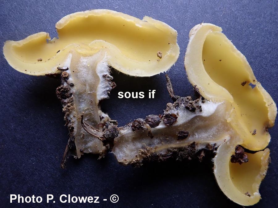 Sowerbyella polaripustulata