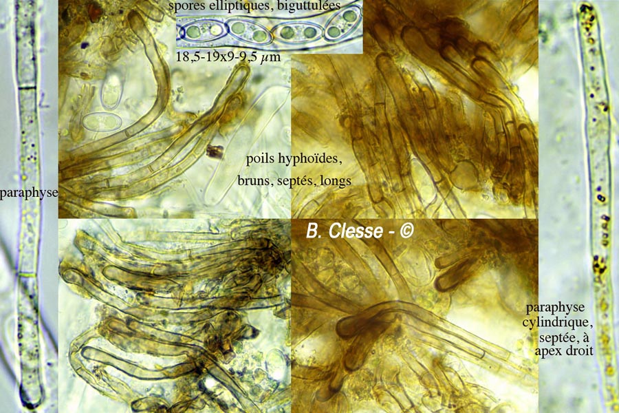 Anthracobia melaloma