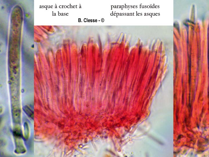 Dasyscyphella montana