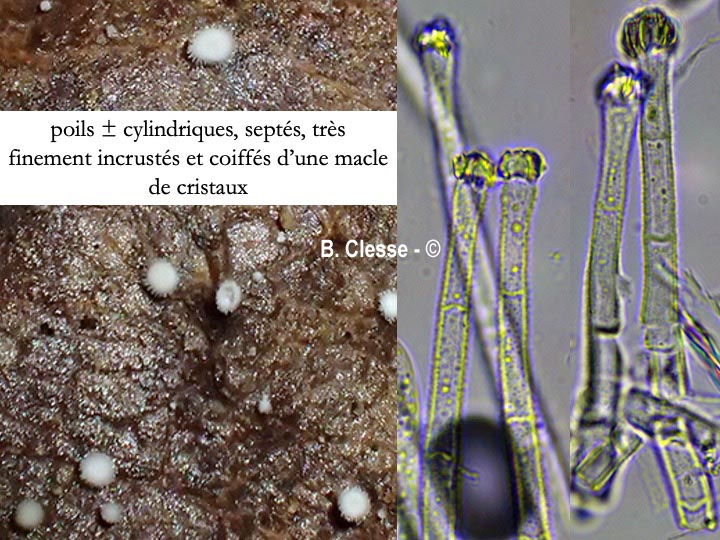 Incrucipulum ciliare