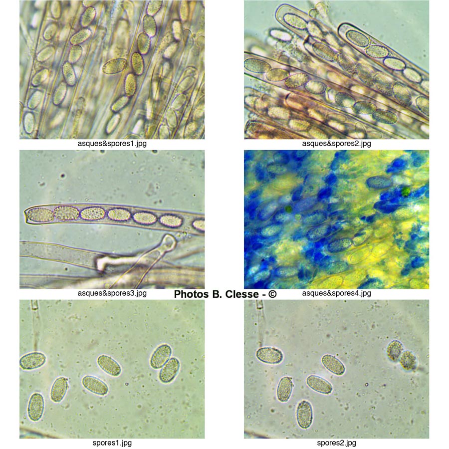 Peziza echinospora