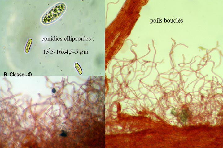 Sarcoscypha austriaca