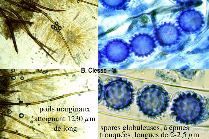 Scutellinia trechispora