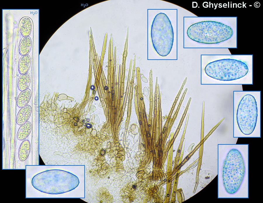 Trichophaea pseudogregaria