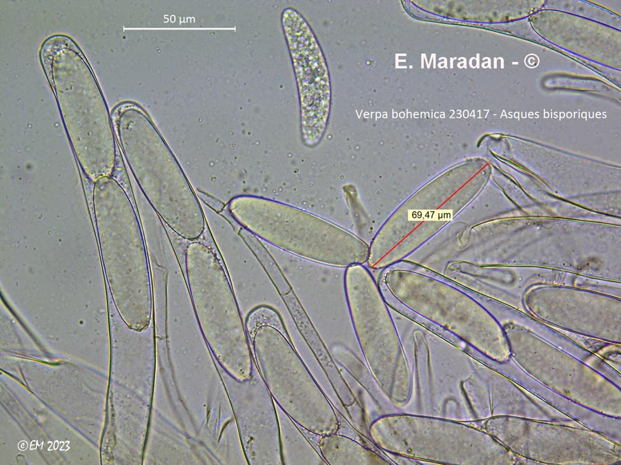 Verpa bohemica (Ptychoverpa bohemica)