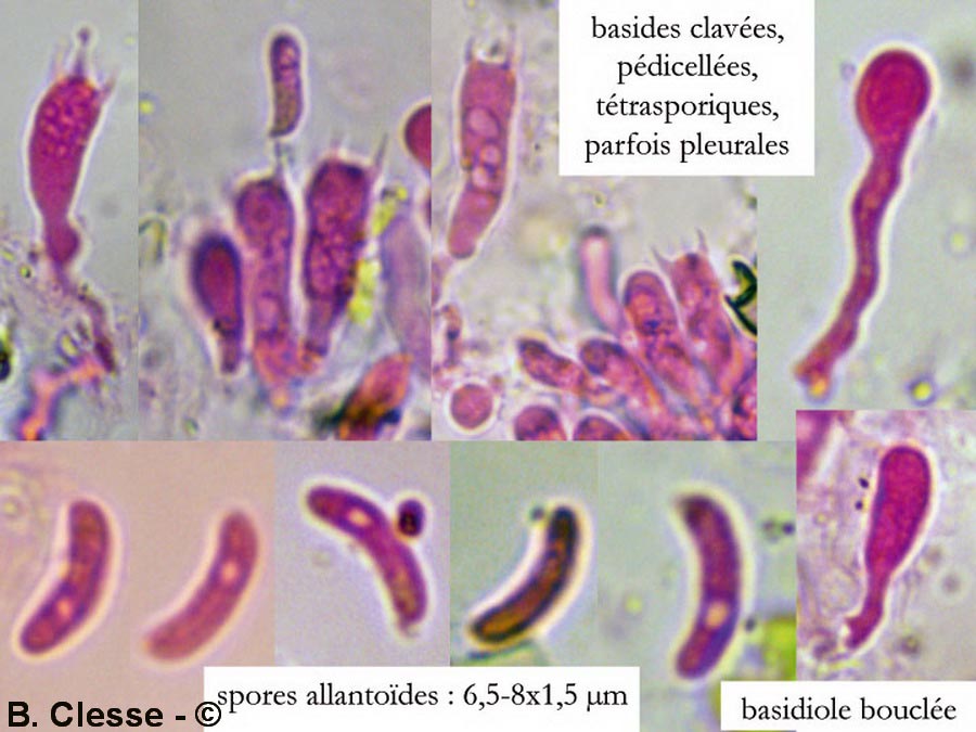 Amyloxenasma elongatisporum