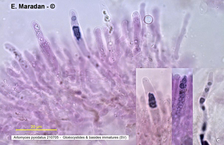 Artomyces pyxidatus