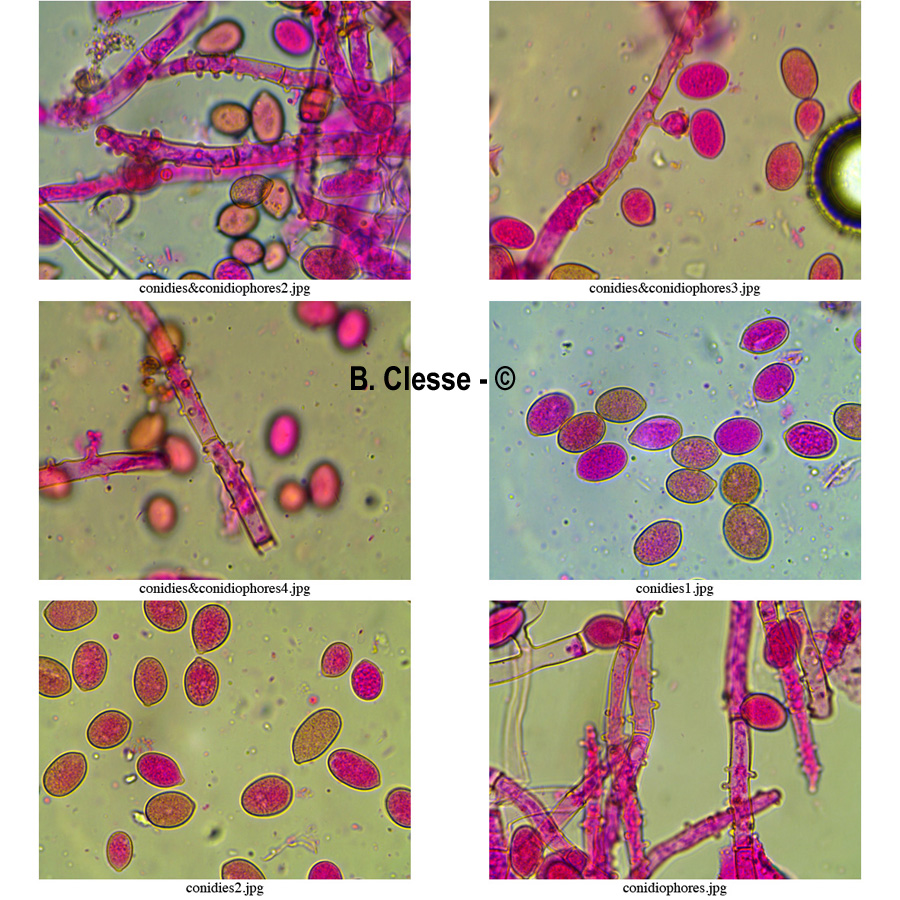Botryobasidium conspersum