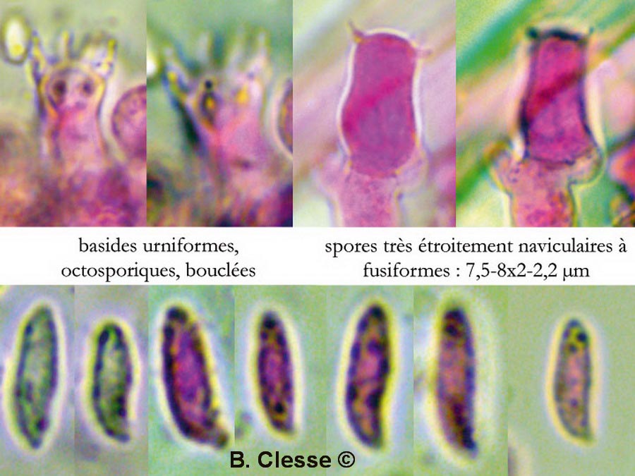 Botryobasidium intertextum