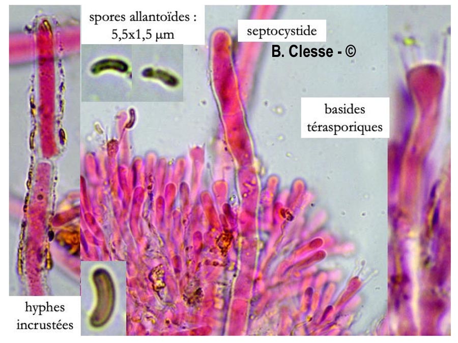 Candelabrochaete septocystidia