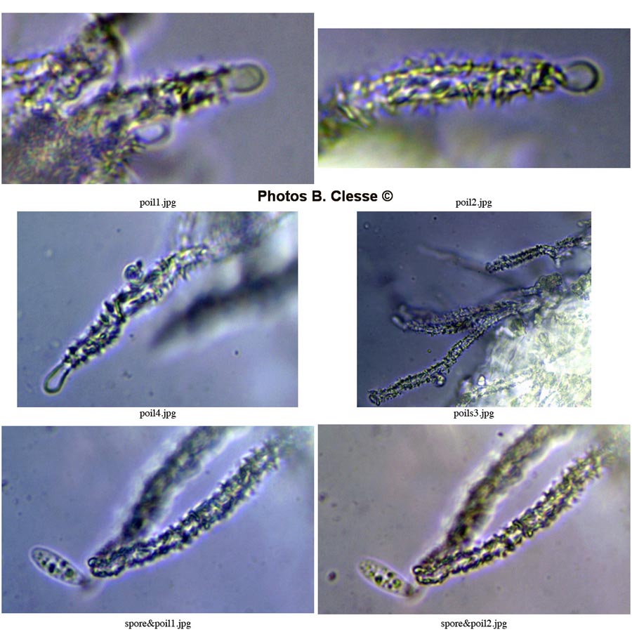 Flagelloscypha mairei