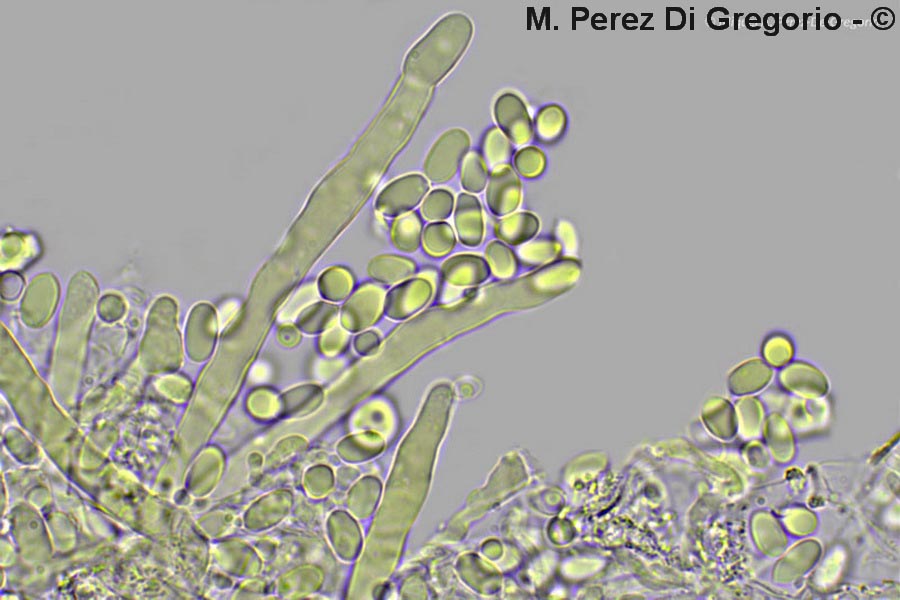 Hyphoderma multicystidium