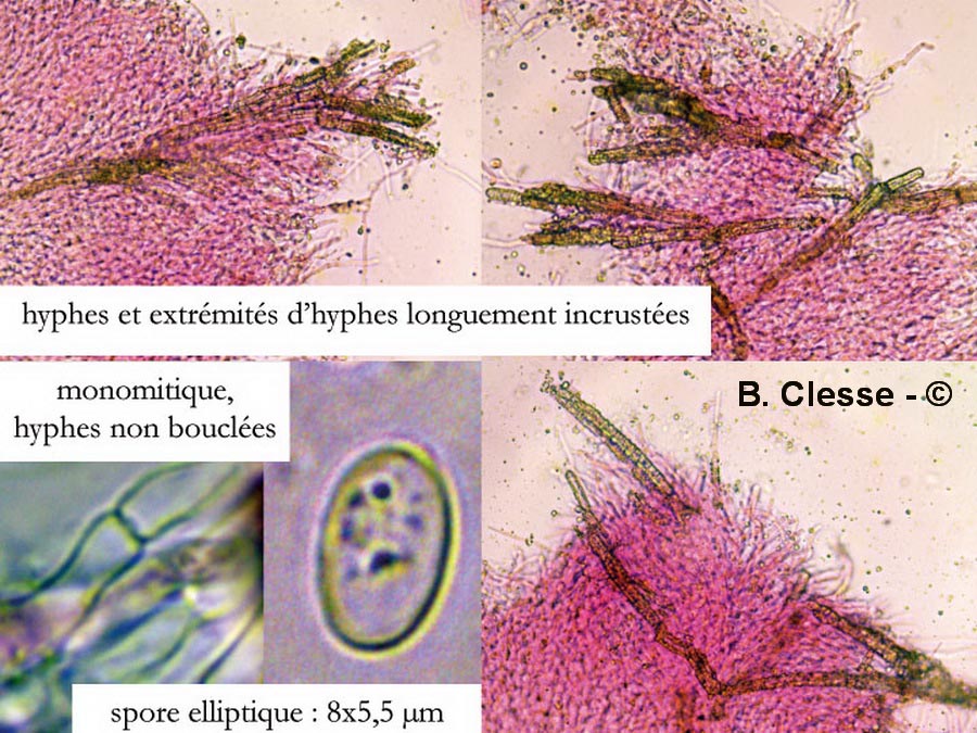 Hyphodermella corrugata