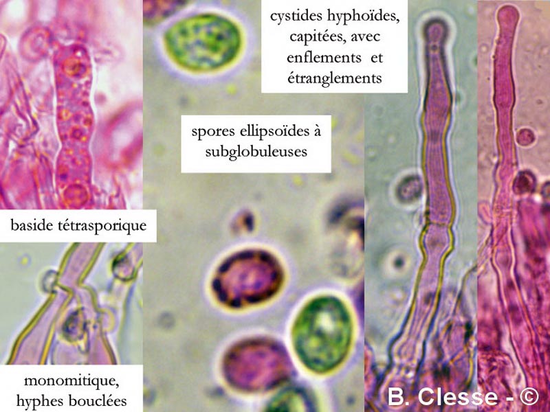 Hyphodontia alutaria