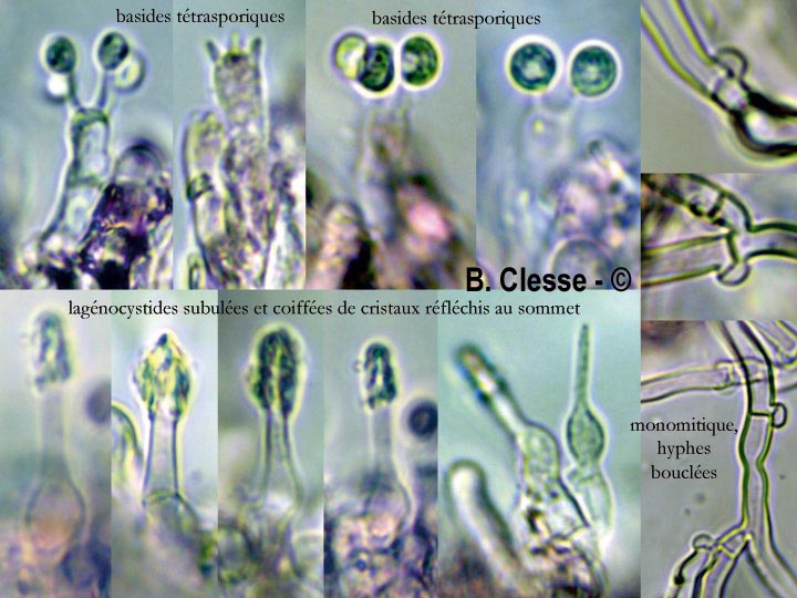 Hyphodontia alutaria