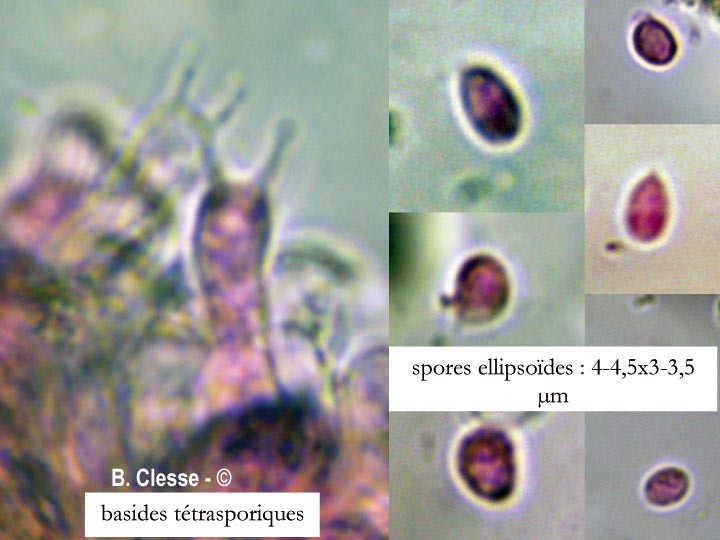 Hyphodontia arguta