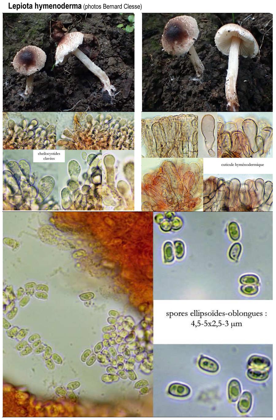 Lepiota hymenoderma