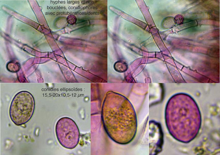 Botryobasidium conspersum