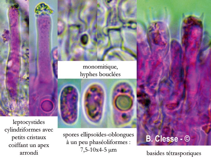 Peniophorella praetermissa (Hyphoderma praetermissum)
