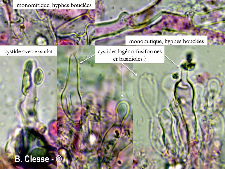 Peniophorella praetermissa (Hyphoderma praetermissum)