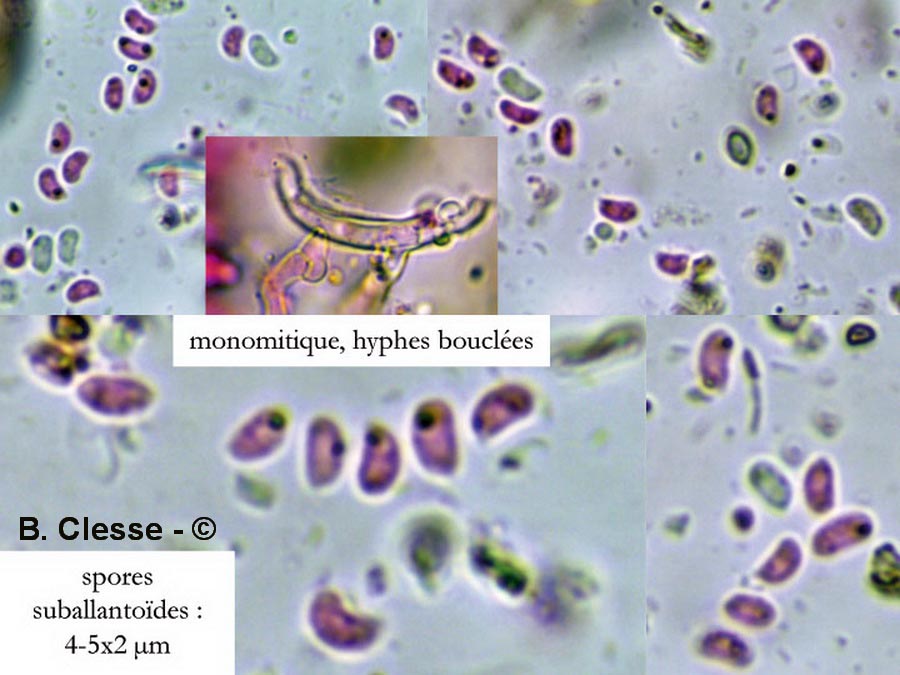 Sistotrema brinkmannii