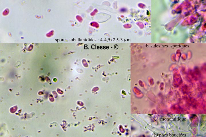 Sistotrema brinkmannii