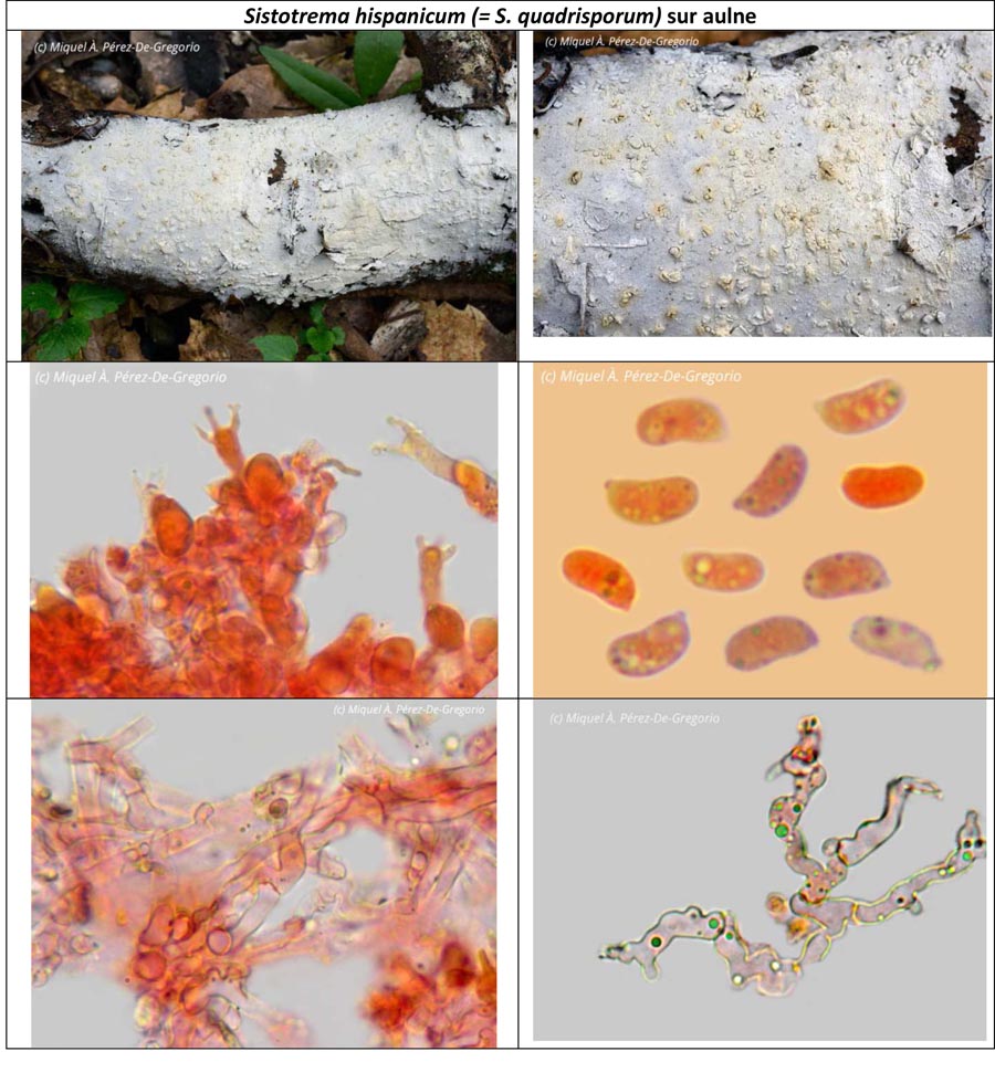 Sistotrema hispanicum